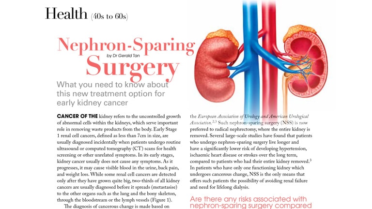 Nephron-Sparing Surgery for Early Kidney Cancer by Dr Gerald Tan