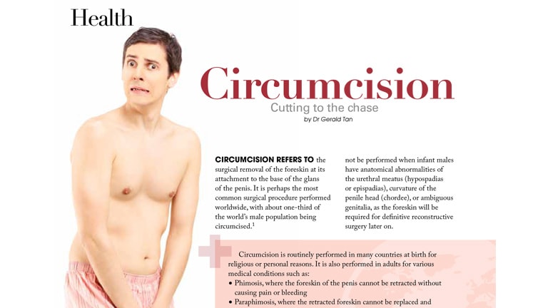 Circumcision – Cutting to the Chase by Dr Gerald Tan